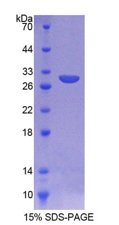 Mouse AGA / Aspartylglucosaminidase Protein (Recombinant His,N-terminus)