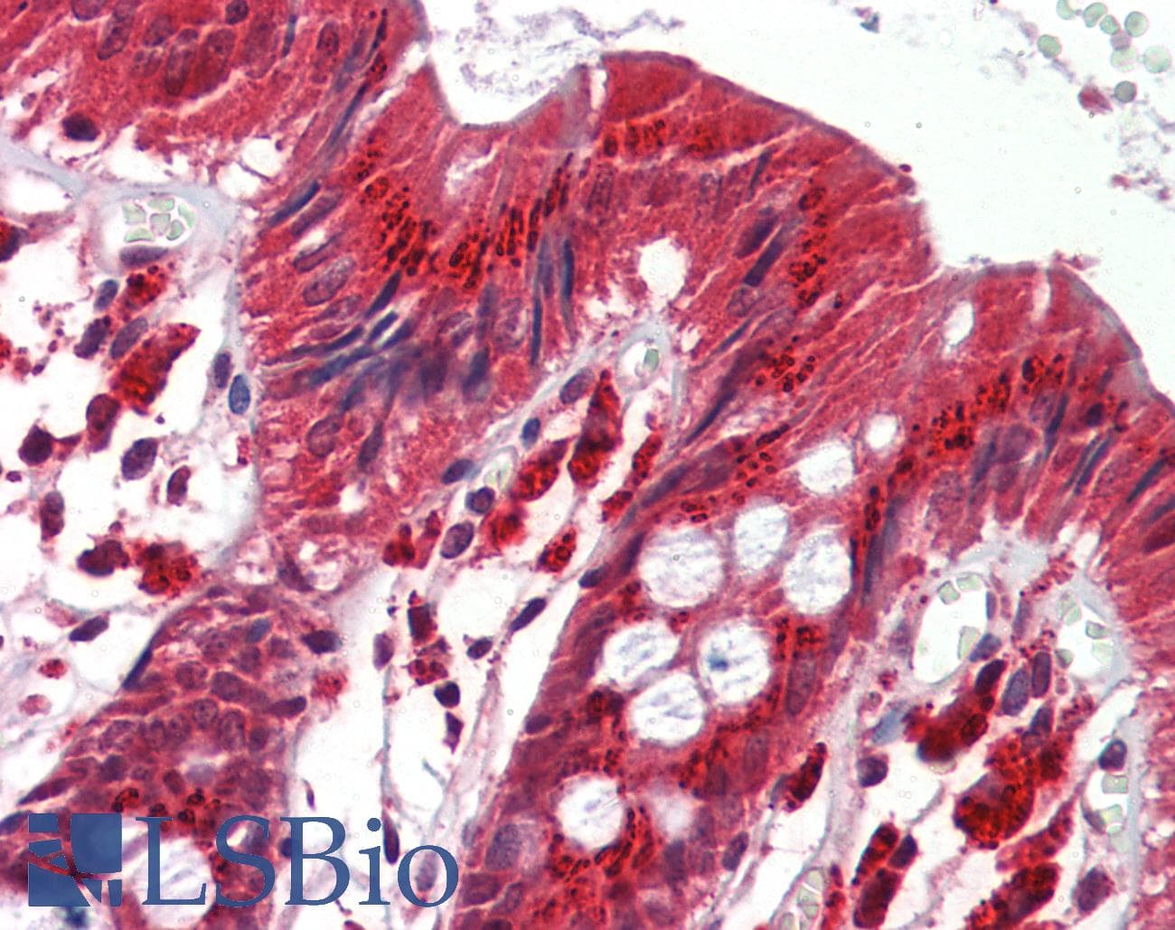 IHC-plus™ ITGB1 / Integrin Beta 1 / CD29 Antibody
