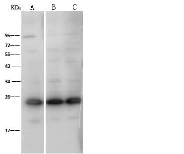 GSTP1 / GST Pi Antibody (Preservative Free)