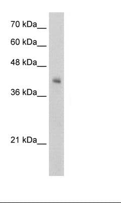 VSIG4 Antibody (aa92-141)
