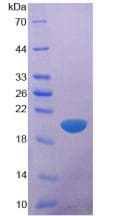 Human GPC1 / Glypican Protein (Recombinant His)