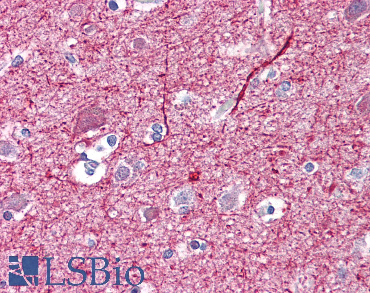 PathPlus™ NEFM / NF-M Antibody (clone RNF403)