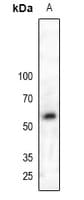 PALS2 / MPP6 Antibody