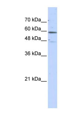 GLUD2 Antibody (N-Terminus)