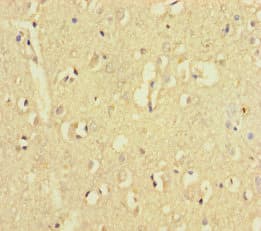ZNF800 Antibody