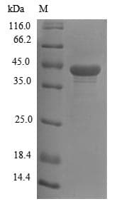 Mouse WNT3 Protein (Recombinant 10His, N-terminus)