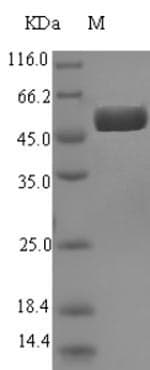 Escherichia coli AGMAT Protein (Recombinant 6His-SUMO, N-terminus)