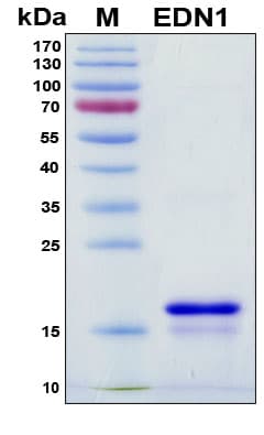 Mouse EDN1 / Endothelin 1 Protein (Recombinant 6His, N-terminus)