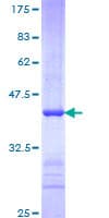 Human FBXW7 / FBW7 Protein (Recombinant GST, N-terminus)