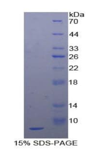 Human EGF Protein (Recombinant His)
