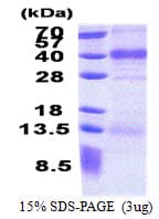 Human FSTL1 Protein (Recombinant His)