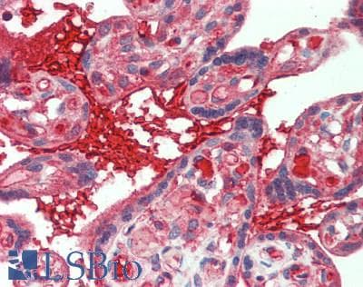 Polyclonal Rabbit anti-Human IL1RL1 Antibody (aa357-532, IHC, WB)