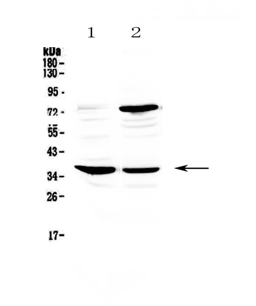 Polyclonal Rabbit anti-Human FCER2 / CD23 Antibody (WB)