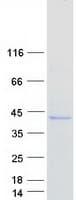 Human FCGRT / FCRN Protein (Recombinant Myc-DDK (Flag))