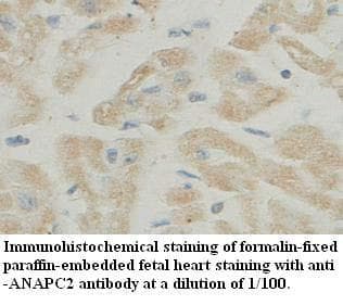 ANAPC2 / APC2 Antibody (aa604-820)