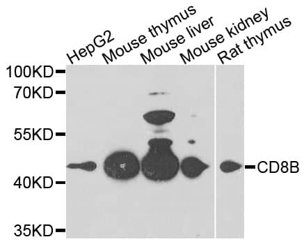 CD8B / CD8 Beta Antibody