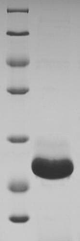 Woodchuck IFN Gamma / Interferon Gamma Protein (Recombinant 6His, N-terminus)