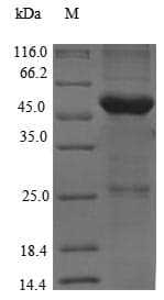 Rat TG / Thyroglobulin Protein (Recombinant 6His-SUMO, N-terminus)
