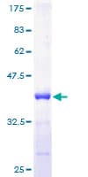 Human Calgizzarin / S100A11 Protein (Recombinant GST)
