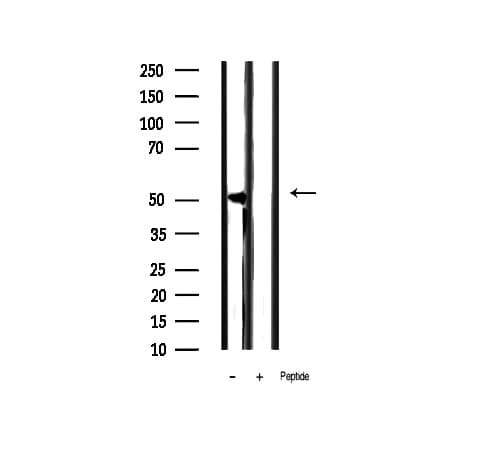 KRT8 / CK8 / Cytokeratin 8 Antibody (phospho-Ser432)