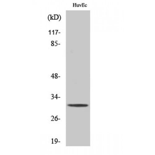 Polyclonal Rabbit anti-Human TIMP3 Antibody (60-140 aa, Internal, WB)