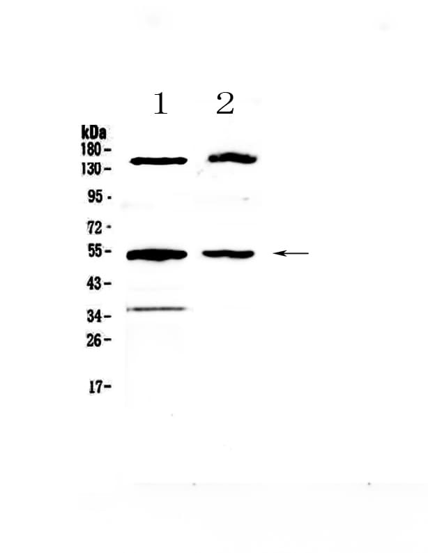 GCK / Glucokinase Antibody