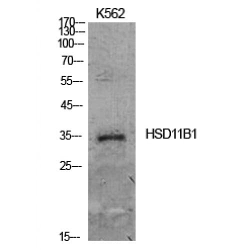 HSD11B1 / HSD11B Antibody (1-50 aa, N-terminal)