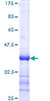 Human SNCA / Alpha-Synuclein Protein (Recombinant GST, N-terminus)