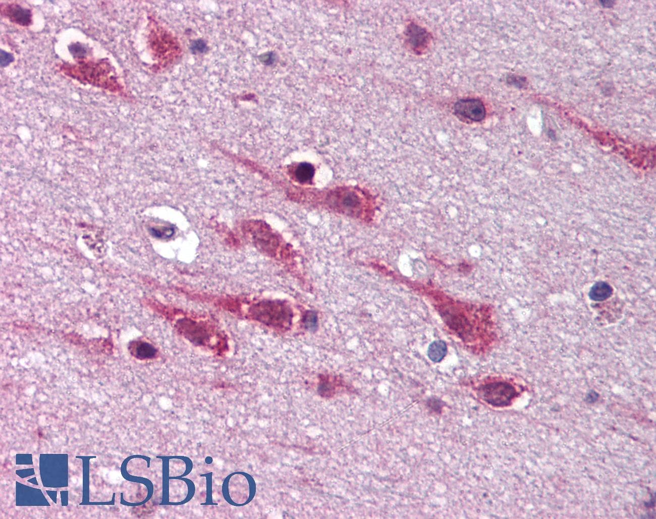 IHC-plus™ Polyclonal Rabbit anti-Human MAPK9 / JNK2 Antibody (C-Terminus, IHC, WB)
