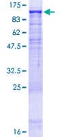 Human Dipeptidylpeptidase 10 / DPP10 Protein (Recombinant GST)