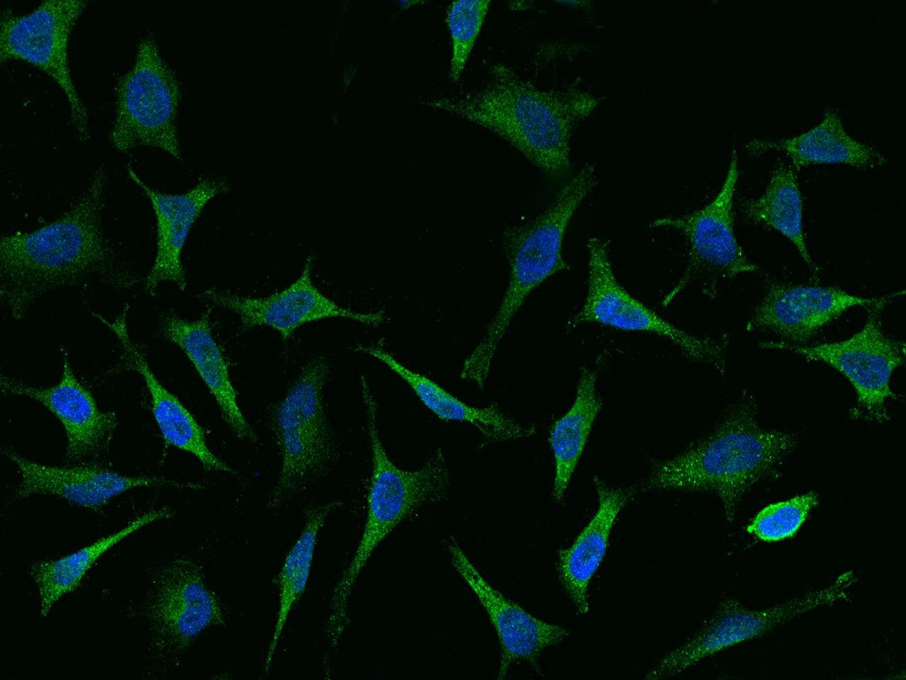 Polyclonal Rabbit anti-Human CAP1 Antibody (IF, WB)