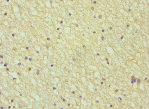 AMPH / Amphiphysin Antibody (aa340-620)