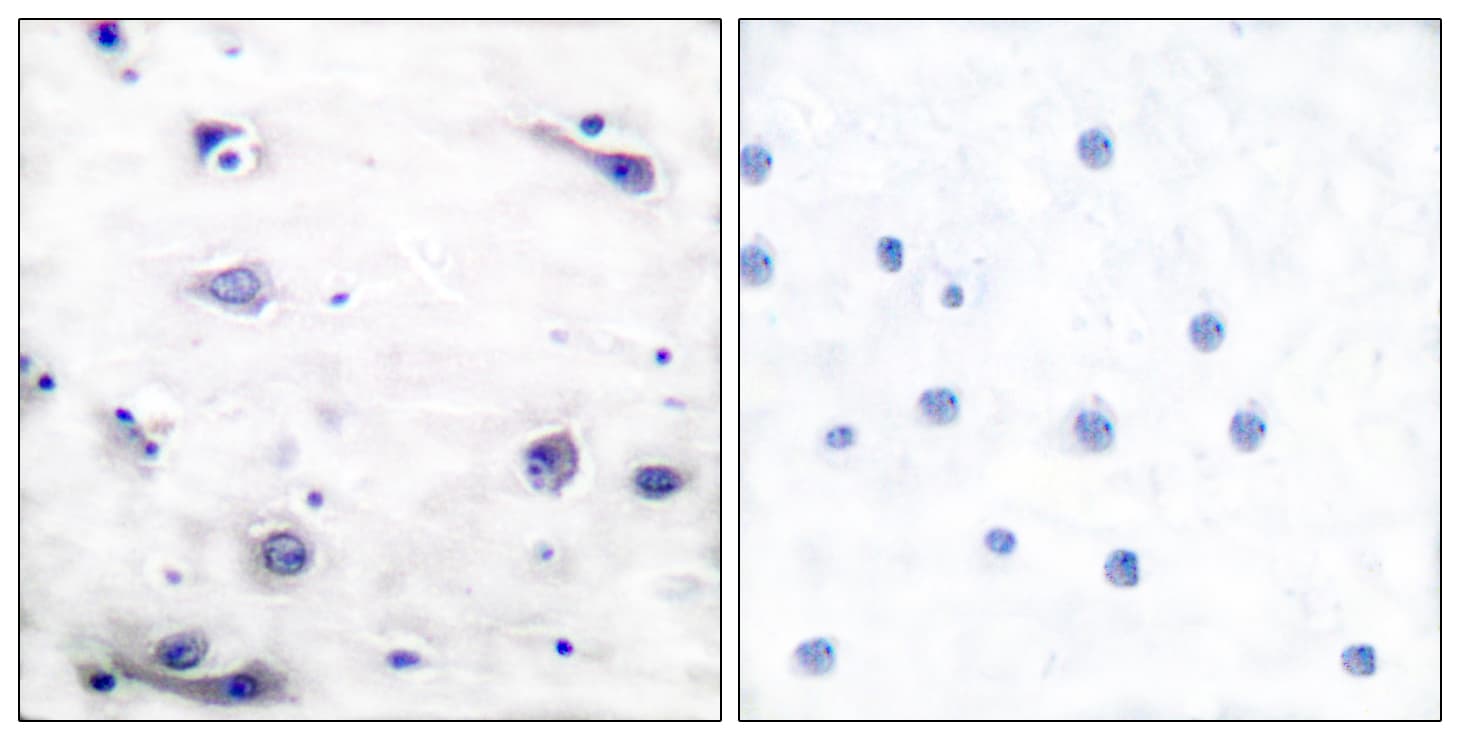 Polyclonal Rabbit anti-Human MAPT / Tau Antibody (phospho-Ser422, IHC, WB)