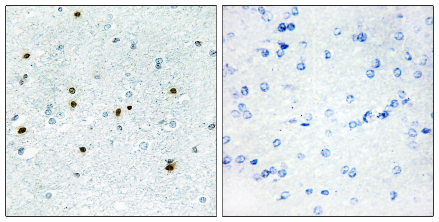 Polyclonal Rabbit anti-Human DCLK3 / CLR Antibody (aa291-340, IHC)