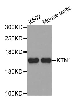 Polyclonal Rabbit anti-Human KTN1 / Kinectin Antibody (IHC, WB)