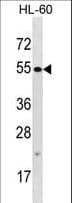 TTC34 Antibody (aa529-558)