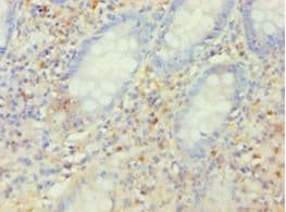 KCNJ10 / SESAME / KIR4.1 Antibody (aa165-379, FITC)