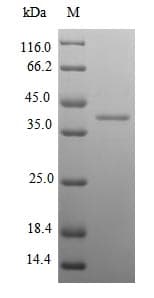Mouse KLK14 / Kallikrein 14 Protein (Recombinant 6His-SUMO, N-terminus)