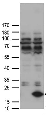 FABP12 Antibody