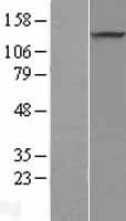 PRDM10 / TRIS Protein (Over-Expression Lysate Myc-DDK (Flag))