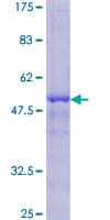 Human DKK1 Protein (Recombinant GST)