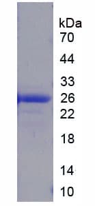 Rat HMGB3 Protein (Recombinant His, N-Terminal)