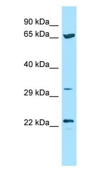 Polyclonal Rabbit anti-Human CD275 / B7-H2 / ICOS Ligand Antibody (aa76-125, WB)