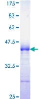 Human NCK1 / NCK Protein (Recombinant GST, N-terminus)