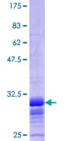 Human SLC2A2 / GLUT2 Protein (Recombinant GST, N-terminus)