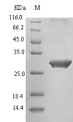 Human TIGIT Protein (Recombinant 6His-SUMO, N-terminus)