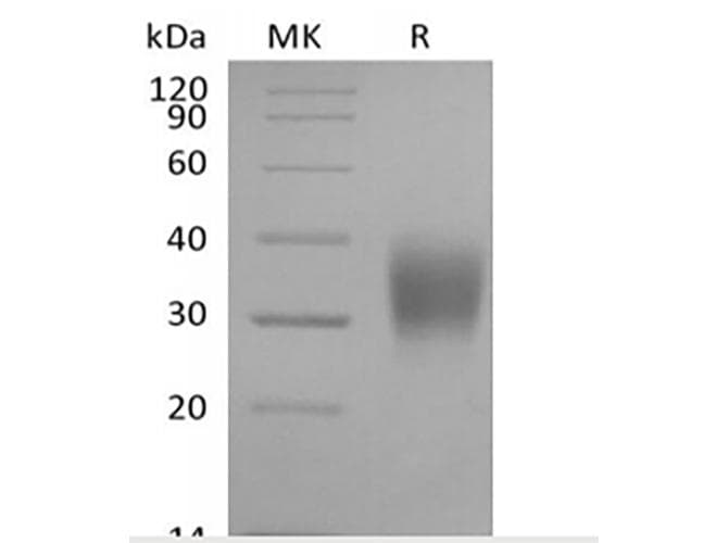 Cynomolgus FCGR3A / CD16A Protein (Recombinant 6His, C-terminus)