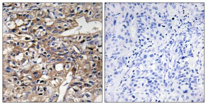 RECK Antibody