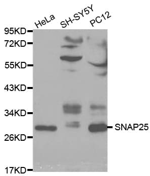 Polyclonal Rabbit anti-Human SNAP25 Antibody (IHC, IF, WB)