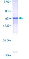 Human CD66c / CEACAM6 Protein (Recombinant GST)